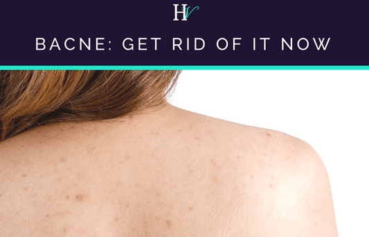 Bacne: Get rid of it NOW - HueVine Wellness + Spa