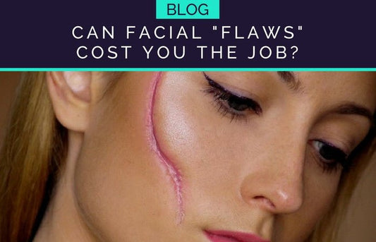 Birthmarks, Scars and Other Facial "Flaws" May Make it Harder to Land a Job - HueVine Wellness + Spa