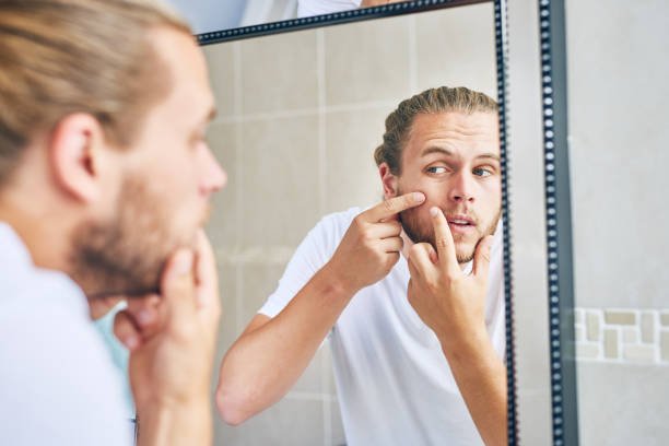 can-facial-hair-cause-acne-the-truth-about-acne-facial-hair