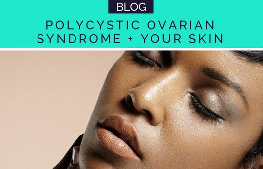 POLYCYSTIC OVARIAN SYNDROME AND YOUR SKIN - HueVine Wellness + Spa