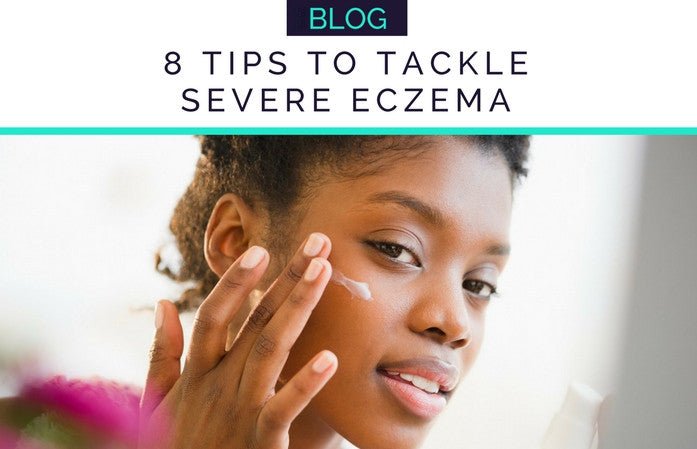 SEVERE ECZEMA + HOW TO TACKLE IT - HueVine Wellness + Spa