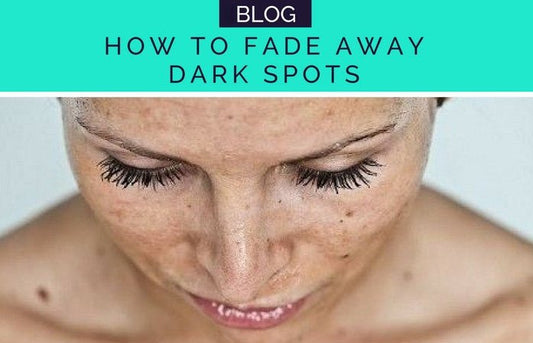 TRY THESE SIMPLE TRICKS TO FADE AWAY DARK SPOTS - HueVine Wellness + Spa